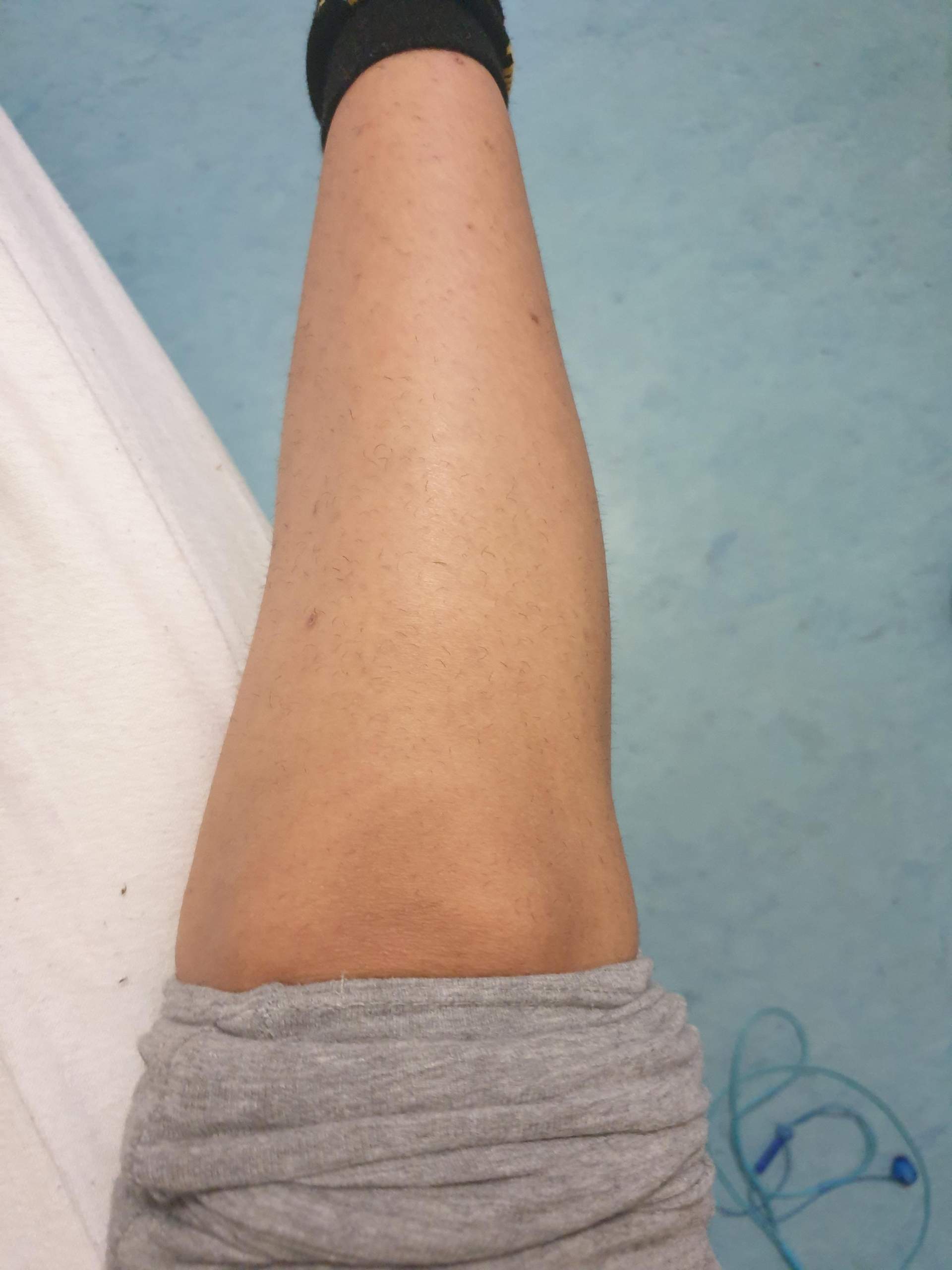 Geschwollenes Bein was kann das sein? (Schmerzen, Fitness)