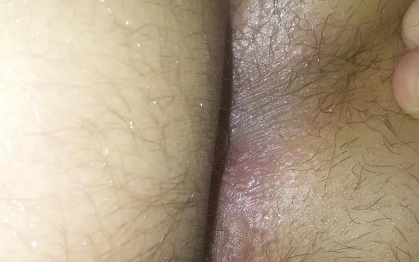 Ob motschewoj von der Hämorrhoide weh tun kann