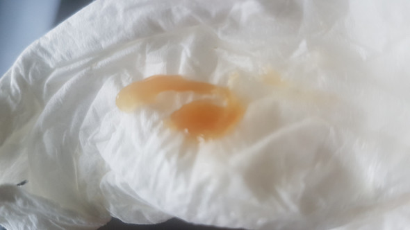 Sind Meine Probleme Eine Reaktion Meines Korpers Auf Das Nichtrauchen Husten Lunge Rauchen Sind Meine Probleme Eine Reaktion Meines Korpers Auf Das Nichtrauchen Husten Lunge Rauchen