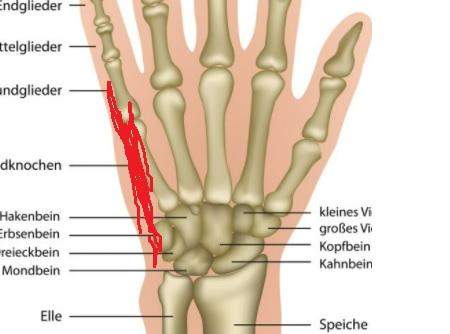 Handgelenk tut an der äußeren Handseite weh - Heilt es von alleine?
