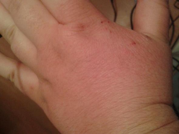 Haut An Den Handen Extrem Trocken Und Reisst Auf Was Soll Ich Dagegen Tun Hand Trockene Haut Haut An Den Handen Extrem Trocken Und Reisst Auf Was Soll Ich Dagegen Tun Hand Trockene Haut