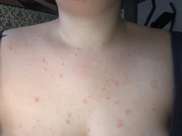 - (Haut, Gesundheit und Medizin)