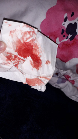 Hellrote Vaginale Blutung Was Kann Das Sein Schwangerschaft Gynakologie Hellrote Vaginale Blutung Was Kann Das Sein Schwangerschaft Gynakologie