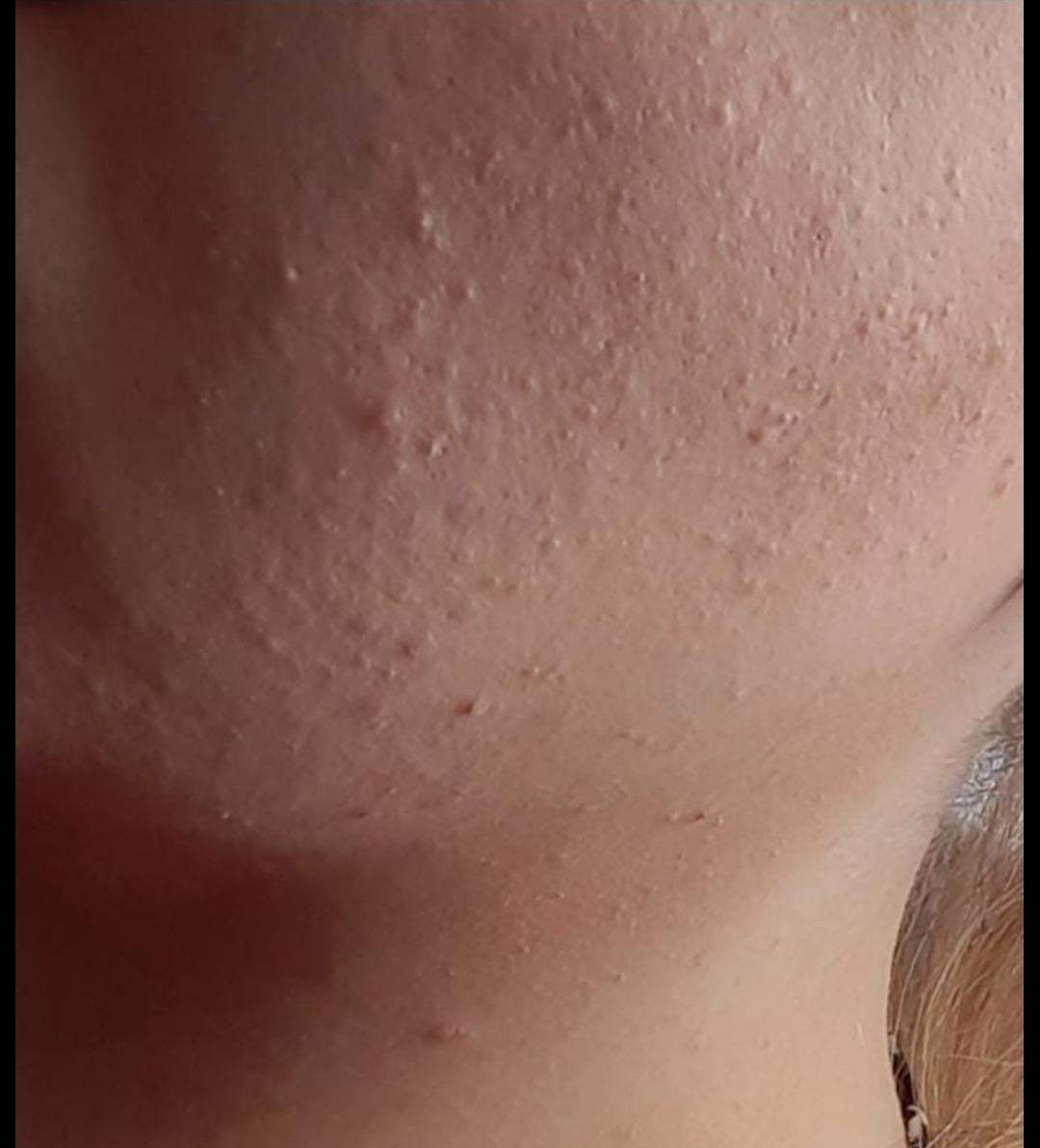 Hilfe! Meine Haut? (Dermatologie)