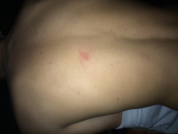 Hiv Durch Speicher Oder Nippel Lecken Aids Hiv Durch Speicher Oder Nippel Lecken Aids