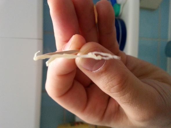 Husten Mit Komischem Auswurf Lunge Bronchitis Husten Mit Komischem Auswurf Lunge Bronchitis