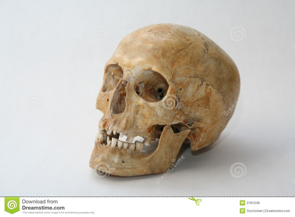 Ich Kann Meine Kiefer Oder Wangenknochen Knacken Lassen Als Ob Ich Meine Fingerknochen Knacken Lasse Ist Das Normal Knochen Ich Kann Meine Kiefer Oder Wangenknochen Knacken Lassen Als Ob Ich Meine Fingerknochen Knacken Lasse Ist Das Normal Knochen