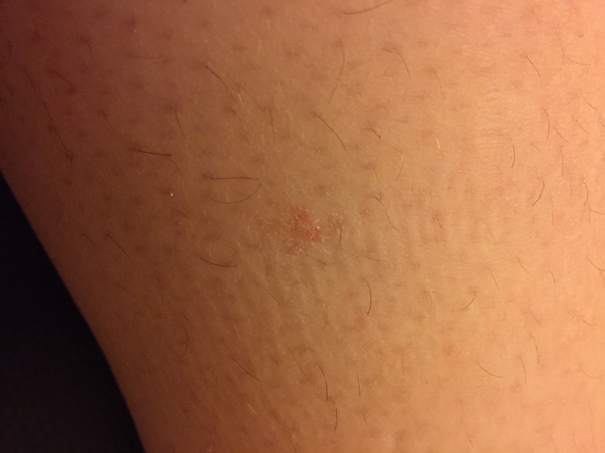 Immernoch Ohne Befund Muskelschmerzen Zuckungen Und Atemprobleme Neurologie Hautprobleme Immernoch Ohne Befund Muskelschmerzen Zuckungen Und Atemprobleme Neurologie Hautprobleme