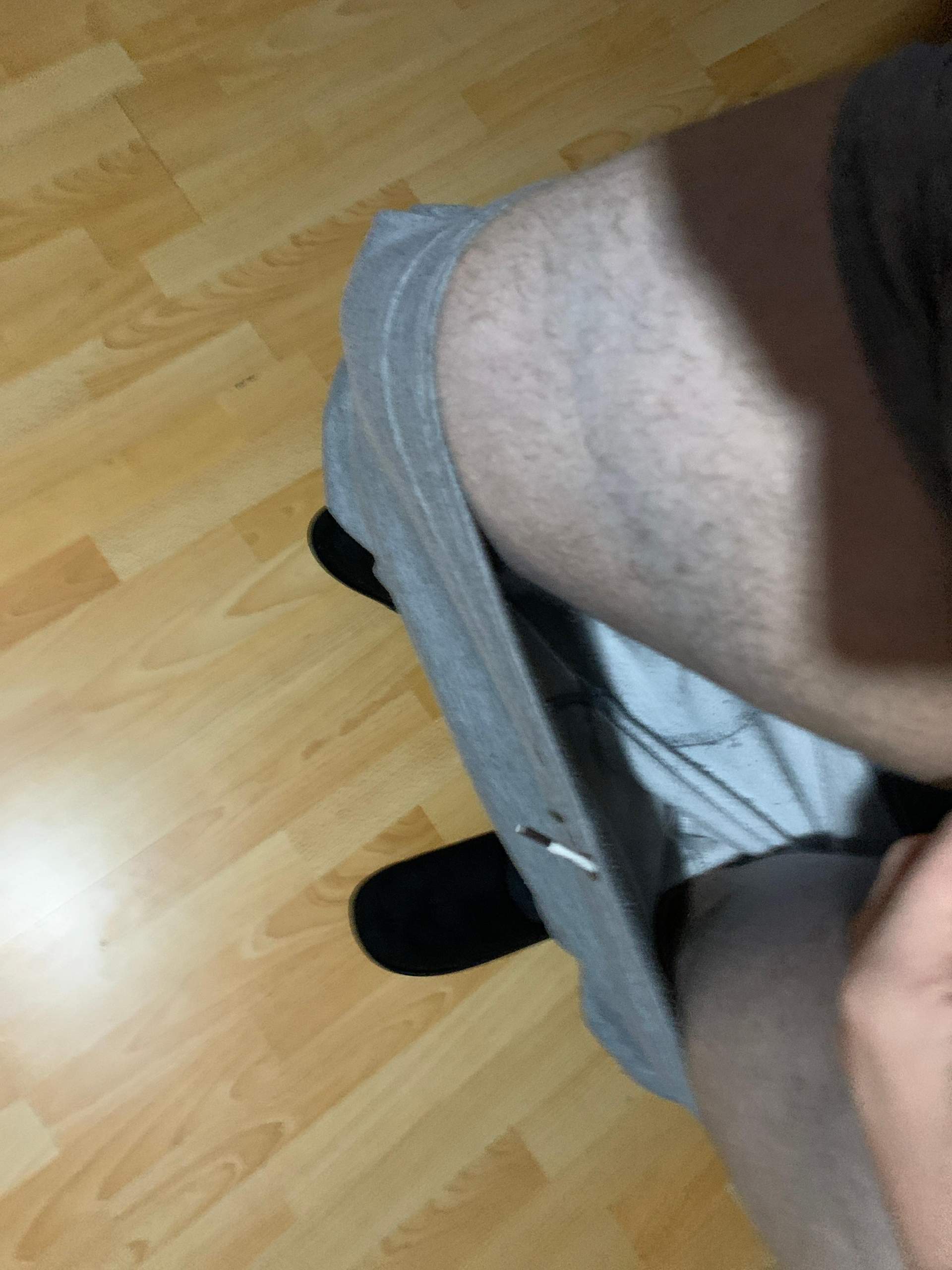 Ist Das Eine Thrombose Beine Ist Das Eine Thrombose Beine