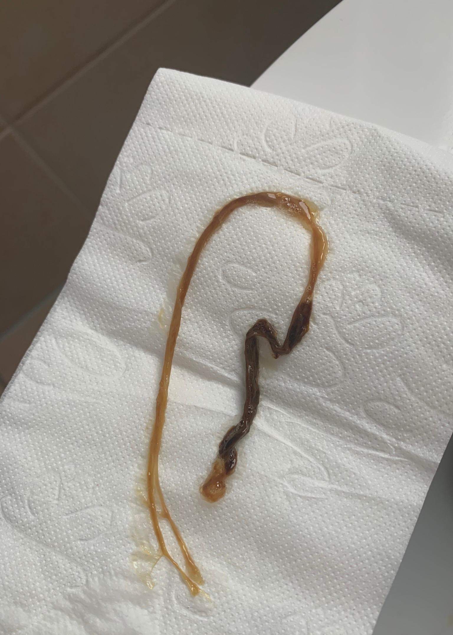 Ist es ein Bandwurm oder etwas anderes? (parasiten)