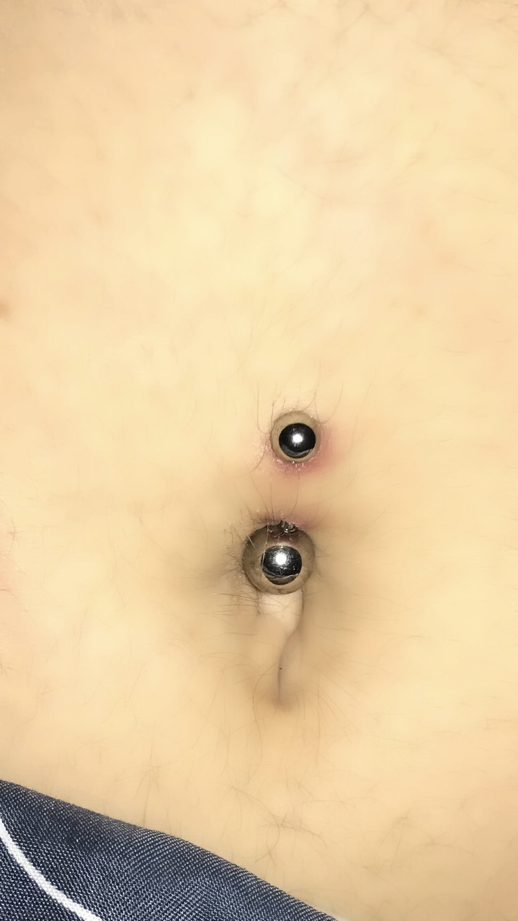 Ist Mein Bauchnabelpiercing Entzundet Haut Allergie Entzundung