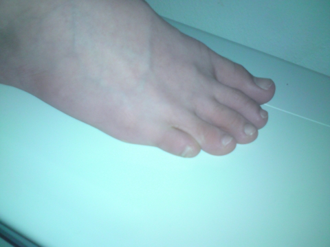 Abnehmen kinder sport Abnehmen kinder sport