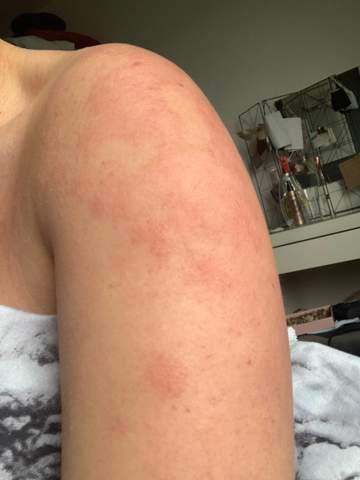 - (Haut, Gesundheit)
