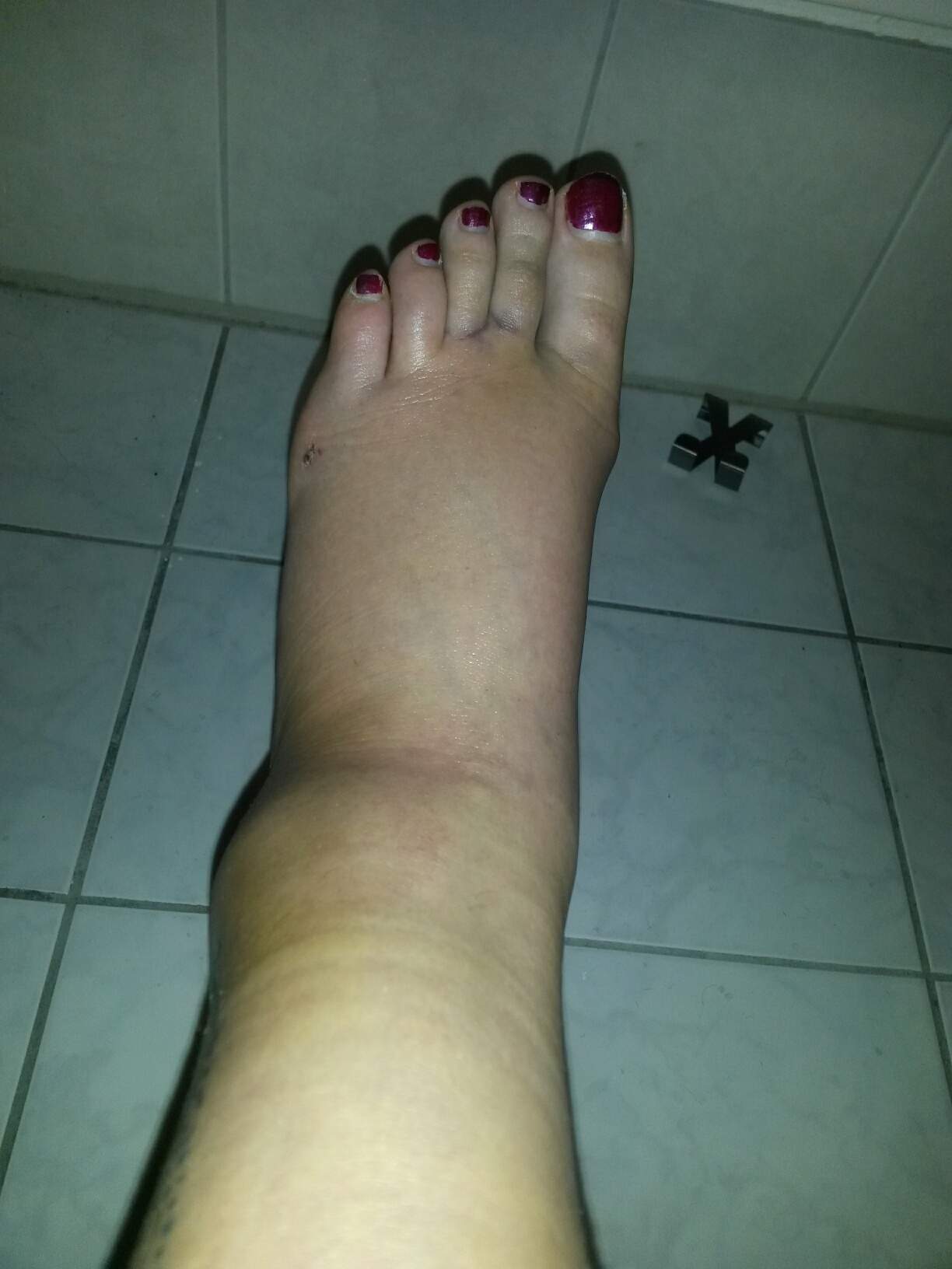 Dusche kleines badezimmer renovieren duschen glasduschen teuscher unternehmen Kapsel- und Bänderriss vor zwei Wochen. Warum habe ich immer noch