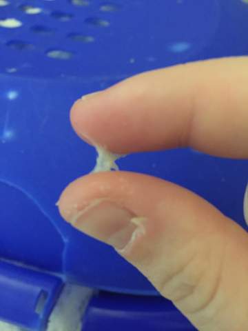 Kennt Jemand Diesen Ausfluss Scheide Ausfluss Kennt Jemand Diesen Ausfluss Scheide Ausfluss