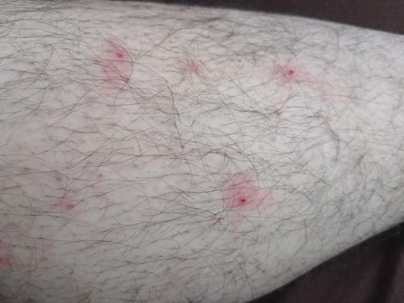 Kleine rote flecken was ist das?