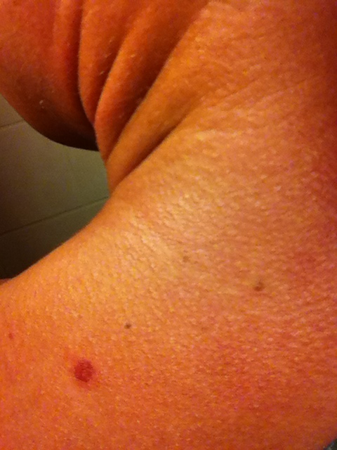 Gerade erst Gerade erst