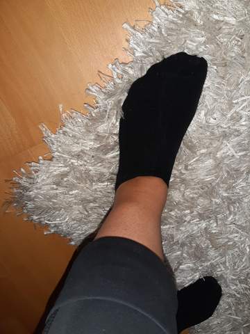 Knubbel Am Schienbein Harmlos Knubbel Am Schienbein Harmlos