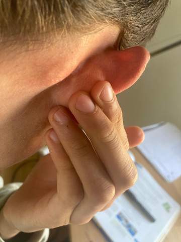 Knubbel Hinter den Ohren (sehr hart)?
