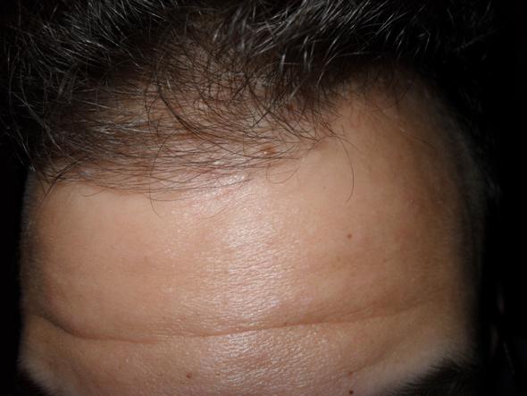 Beim weh bewegen haare tut kopfhaut Kopfhaut schmerzt: