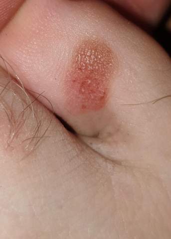 - (Haut, Gesundheit, Vorsorge)