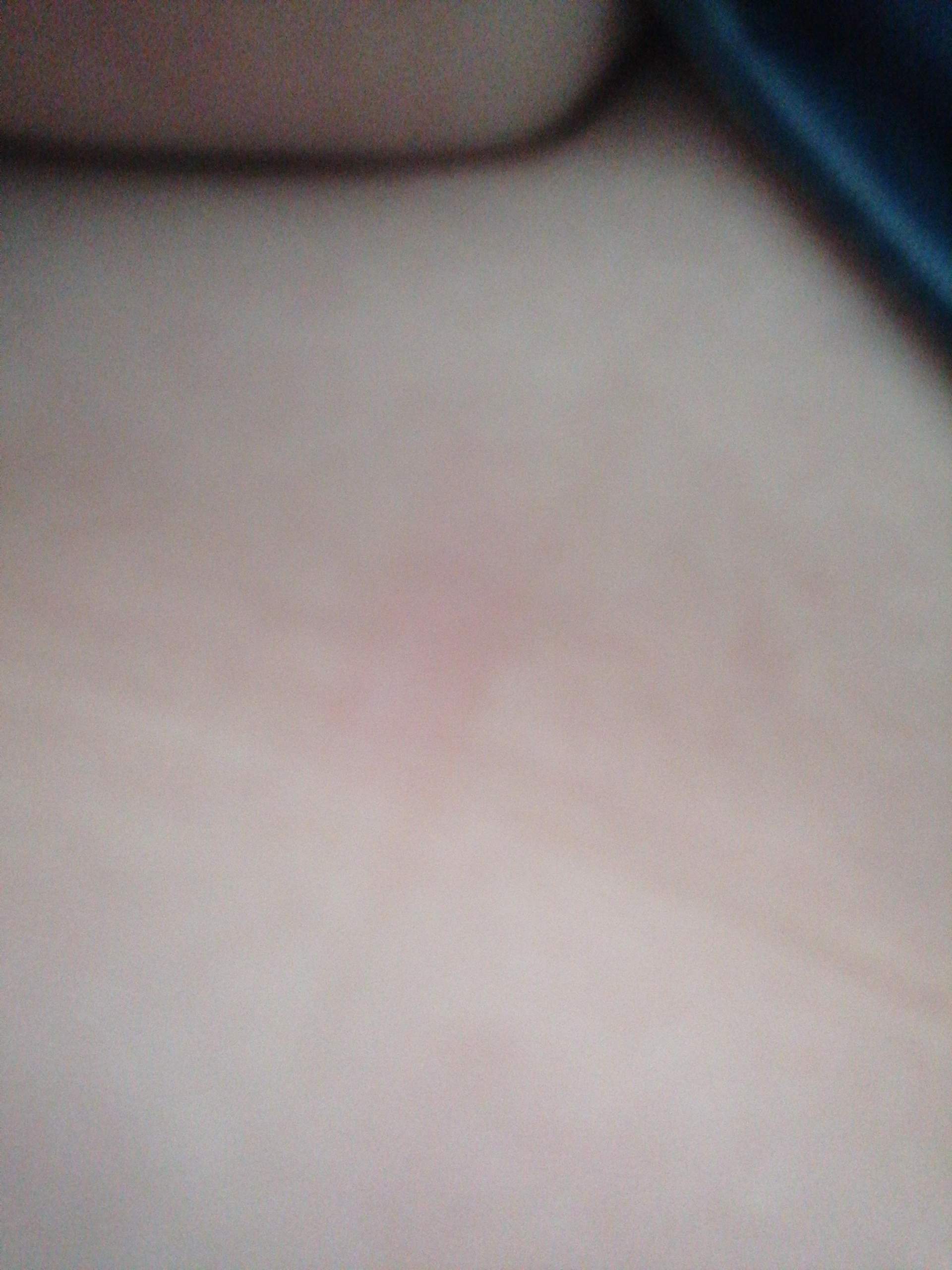 Linea Nigra ohne Ss? (Schwangerschaft, Periode, Gesundheit und Medizin)