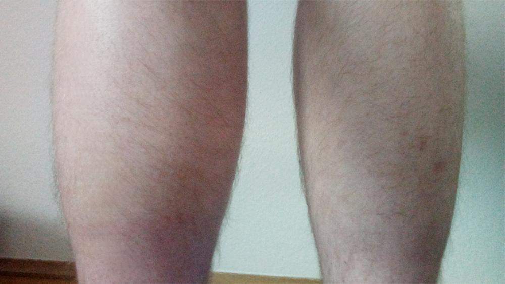 Linke als bein rechtes dicker das Linkes Bein