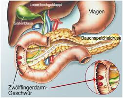 Etwas hilfe. Wenn ihr wissen möchtet wie dass aussieht. - (Magen, Verdauung, Schokolade)