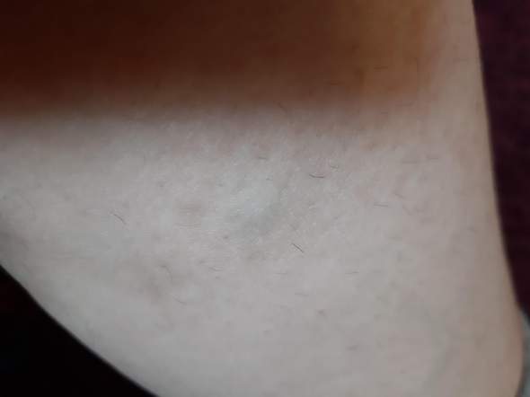 - (Gesundheit, Medizin)