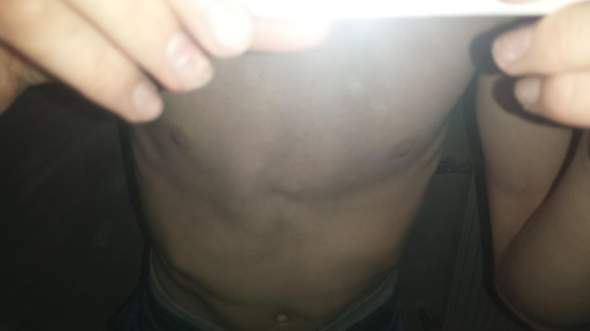 Meine Linke Brust Ist Komisch Meine Linke Brust Ist Komisch