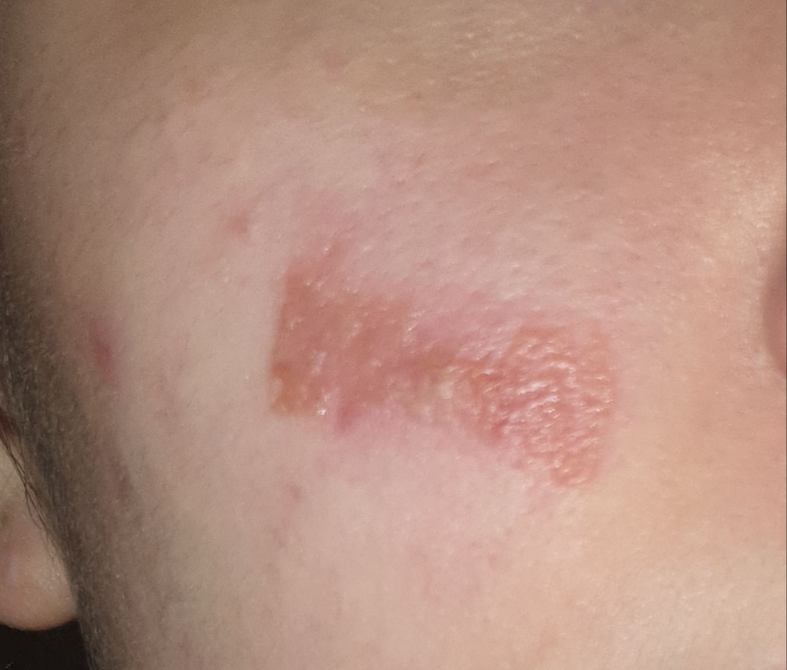 Wie Bekommt Man Wimpernkleber Von Der Haut Ab