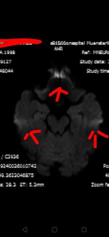 - (Gesundheit, MRT, Neurologie)