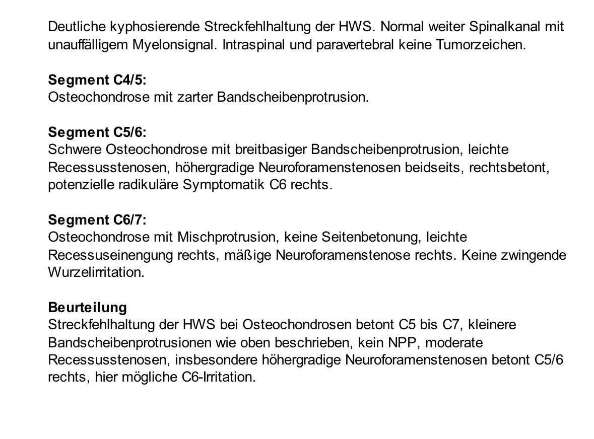 MRT HWS Befund Erklärung? (MRT Befund, MRT Befund Erklärung, HWS Syndrom)