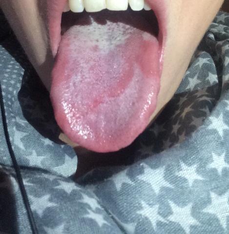 Muster auf der Zunge
