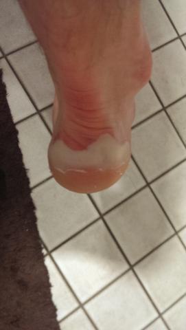 nach dem duschen - (Ferse, Hautkrankheit Fuß)