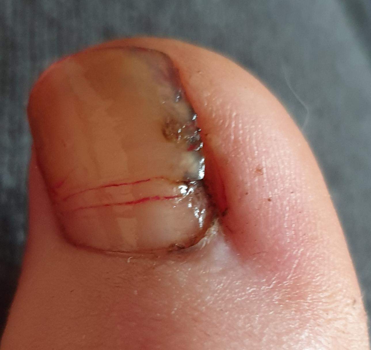 Htle8mgfzkbo M Htle8mgfzkbo M