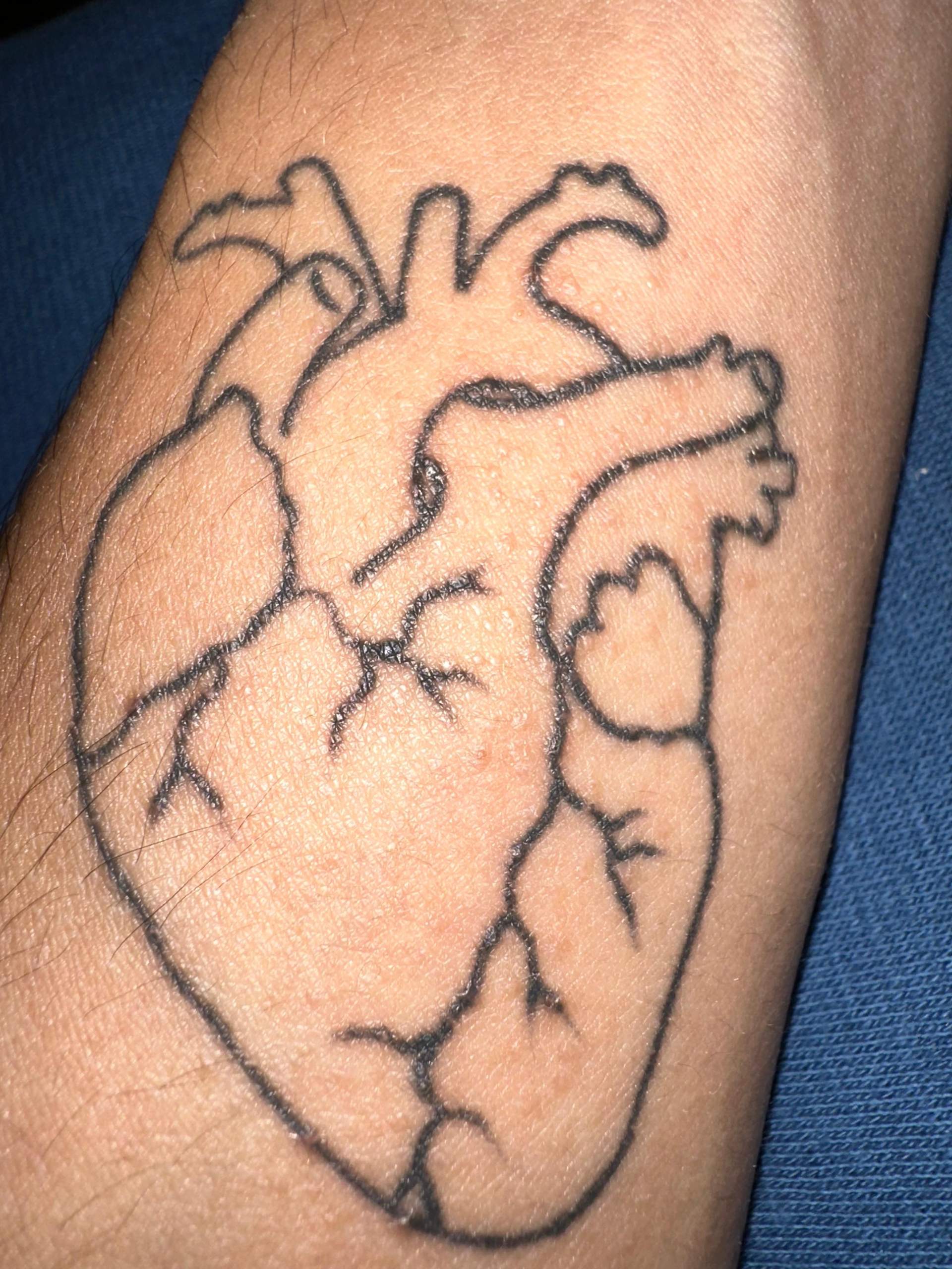 Neues Tattoo mit kleinen Pickeln? (Haut, Pickel, Ausschlag)