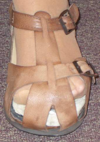 Orthopädische Sandalen tragen?