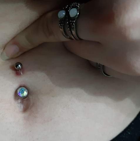 Piercing ist Entzündung?