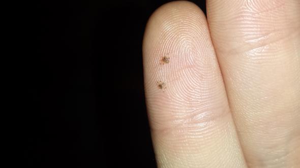 Insekten auf Hand - (parasiten, Insekten)