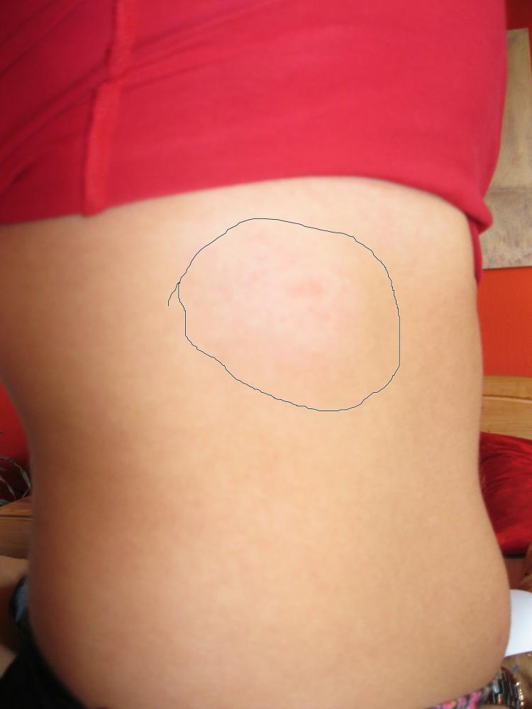 Rippe Gebrellt Oder Was Sonst Schmerzen Arzt Tabletten Rippe Gebrellt Oder Was Sonst Schmerzen Arzt Tabletten
