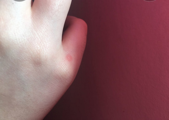 - (Haut, Psyche, Hand)