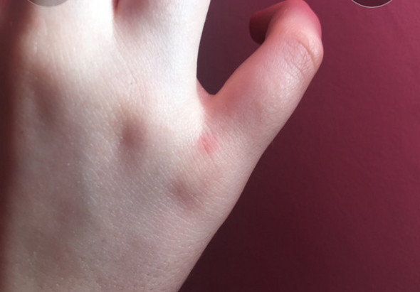 - (Haut, Psyche, Hand)