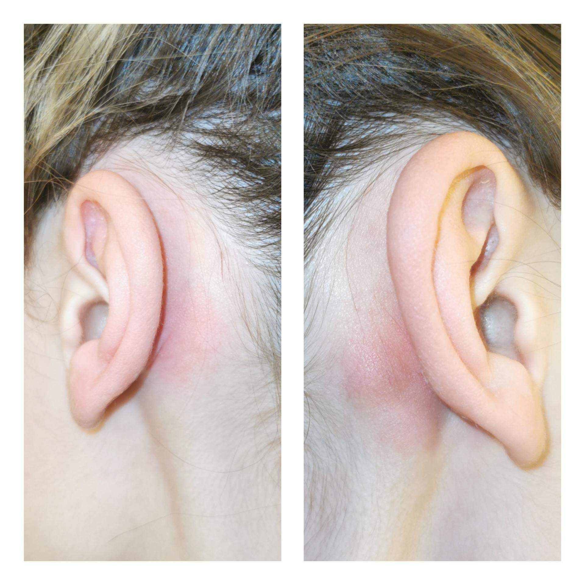 propriétaire oiseau Négligence ohr lymphknoten poids léger organe progéniture