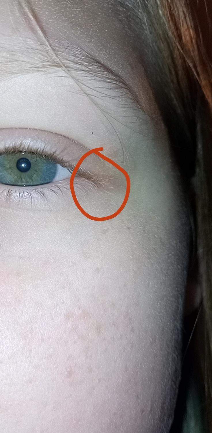 Schmerzen am Auge? (Augen)