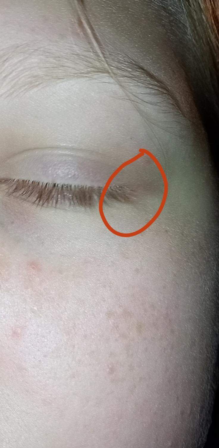 Mein Auge Tut Weh Wenn Ich Es Bewege Schmerzen am Auge? (Augen)