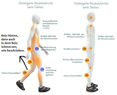 Schmerzen in den Oberschenkeln (Sport, Beine, Muskeln)