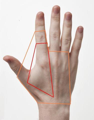 Hand Schmerzbereich - (Schmerzen, Hand, Sehne)