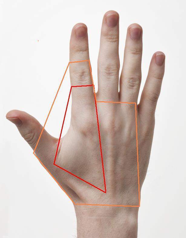 Schmerzen In Mittelhandknochen Oder Sehne Oder Muskel Was Kann Das Sein Hand Schmerzen In Mittelhandknochen Oder Sehne Oder Muskel Was Kann Das Sein Hand