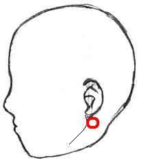 roter Kreis markiert den Ort der Schwellung - (Schmerzen, Schwellung, Ohr)